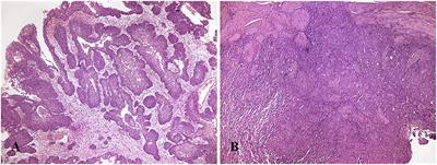 Canine urothelial carcinoma: expression of Periostin in spontaneous canine urothelial carcinoma and its correlation with histological features